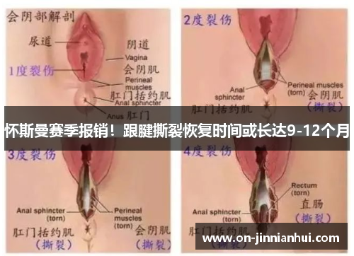 怀斯曼赛季报销！跟腱撕裂恢复时间或长达9-12个月